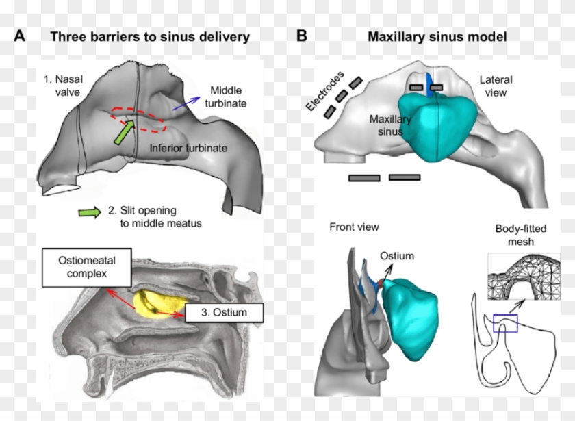 Nose sinus  Airway Model Lateral Nasal  Wall HD  Png 