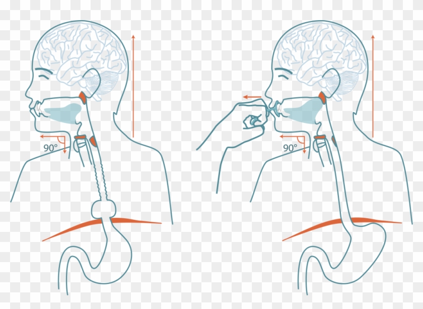 See How The Upper Esophagus Sphincter Does Not Open Cartoon Hd Png Download 1024x699 Pngfind