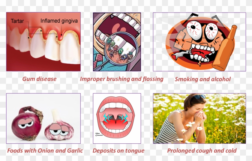 Common Causes Of Bad Breath Or Halitosis - Dental, HD Png Download ...